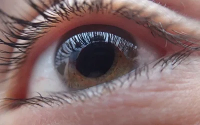 How Common is Glaucoma?