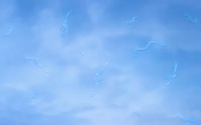 Can Eye Floaters Be a Sign of Something More Serious?